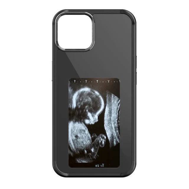 ArtCase™ E-ink Phone Case