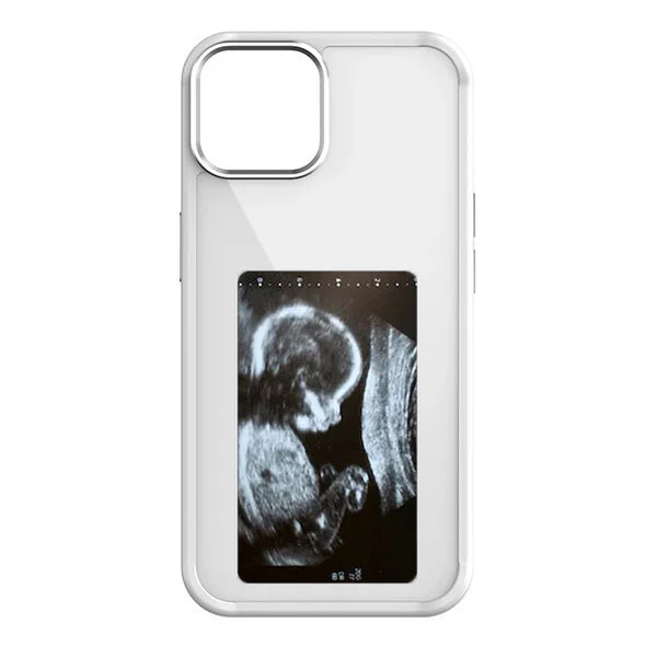 ArtCase™ E-ink Phone Case